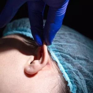 Chirurgie otoplastie pour recoller les oreilles décollées