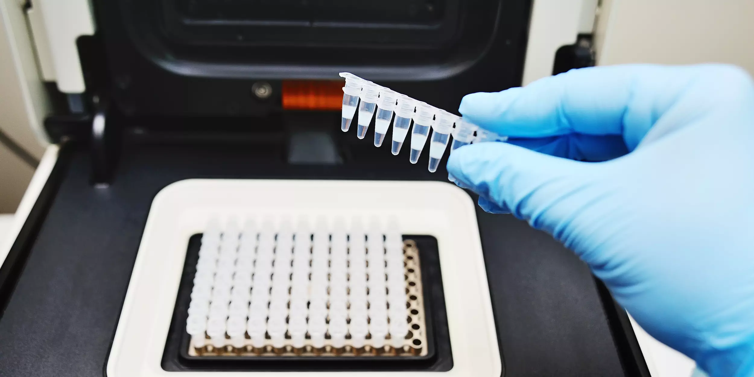 Test ADN Trichotest pour déterminer les causes de l'alopécie androgénétique