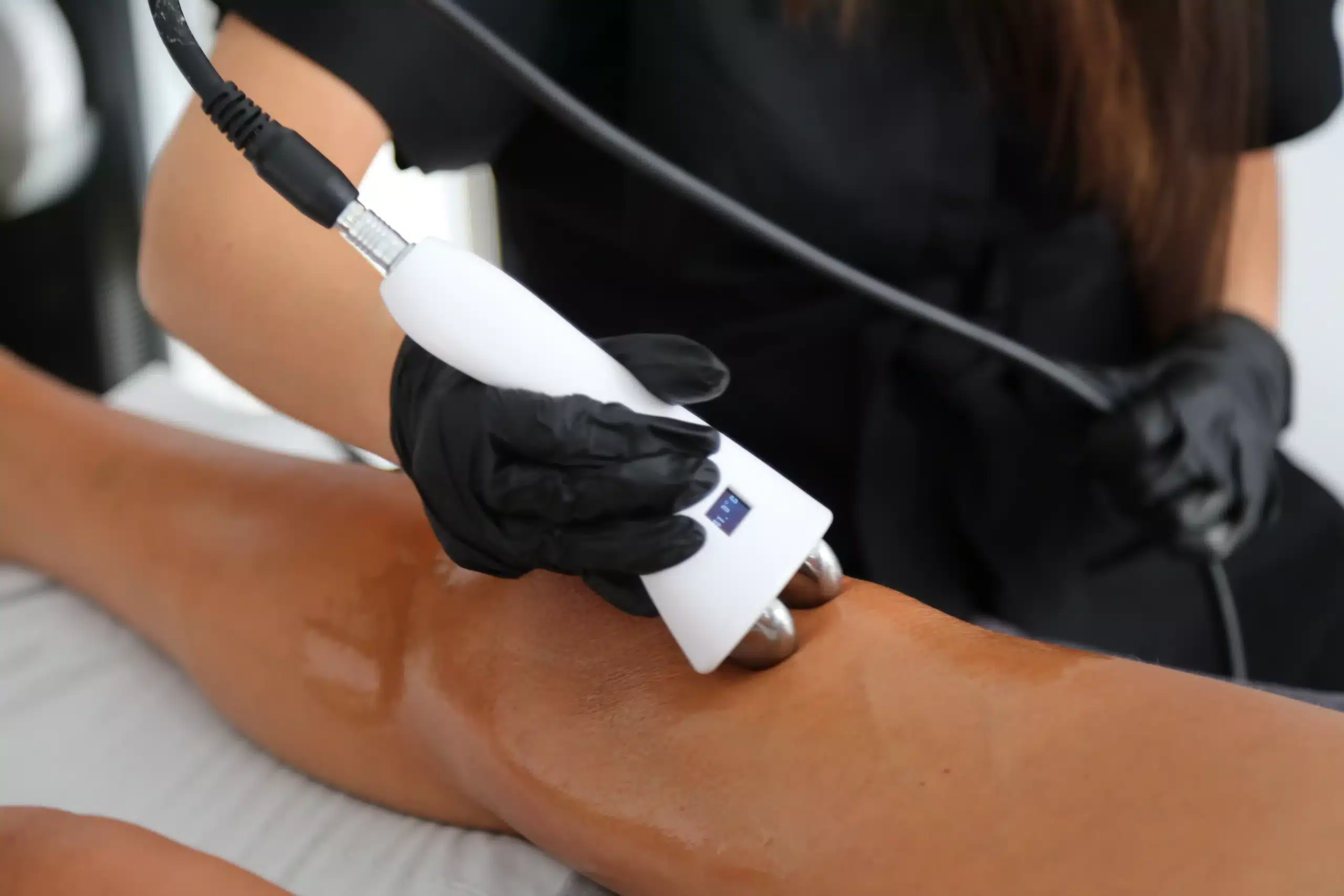 Radiofréquence des jambes pour supprimer la cellulite et retendre la peau