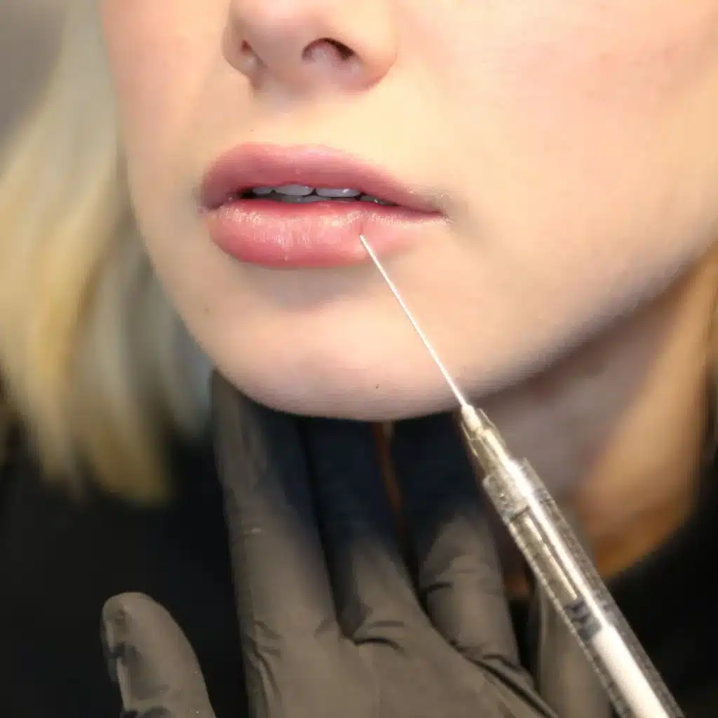 injections