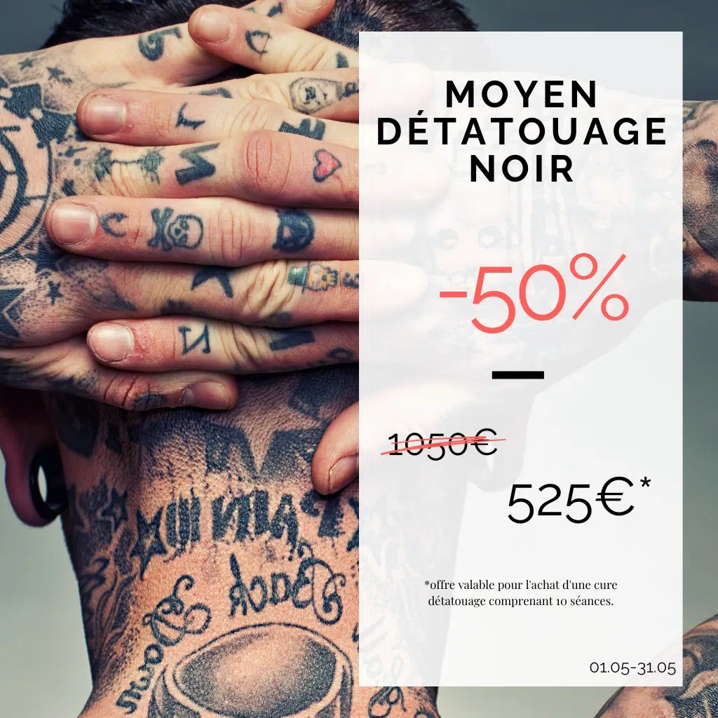 détatouage moyen noir